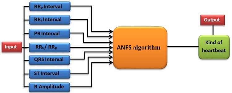 Schematic how to configure the ECG signal and the kind of heartbeat